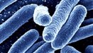 Urinary infection (adult)