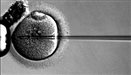 Fertility problems